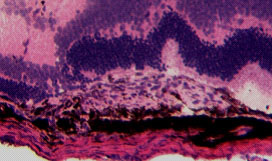 マウス眼に作成した脈絡膜新生血管の切片図